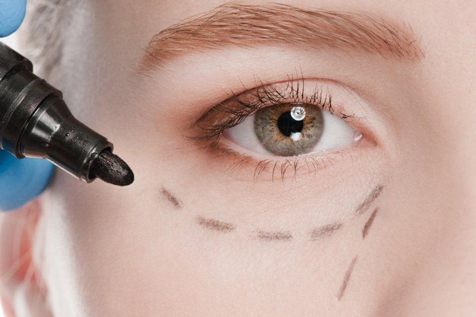 ¿Tu felicidad depende de una cirugía estética?