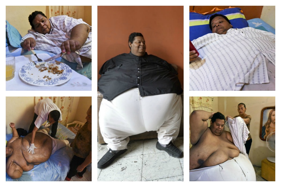 El duro desafío del colombiano más obeso