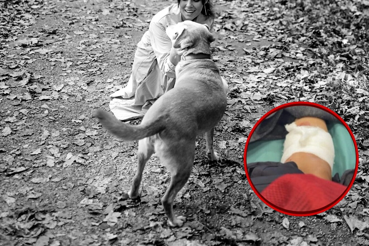 Famosa actriz fue atacada por un pitbull: “Me destrozó la pantorrilla”