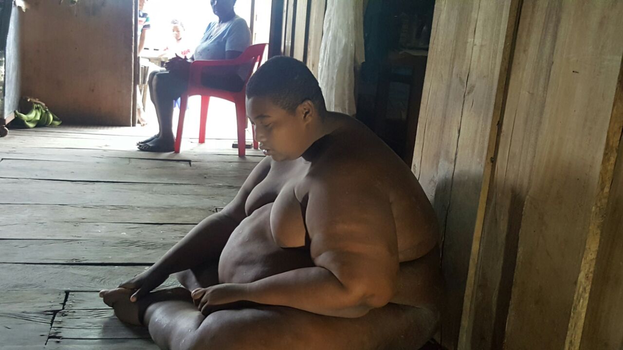 Didier, el hombre más obeso de Colombia, regresa a casa