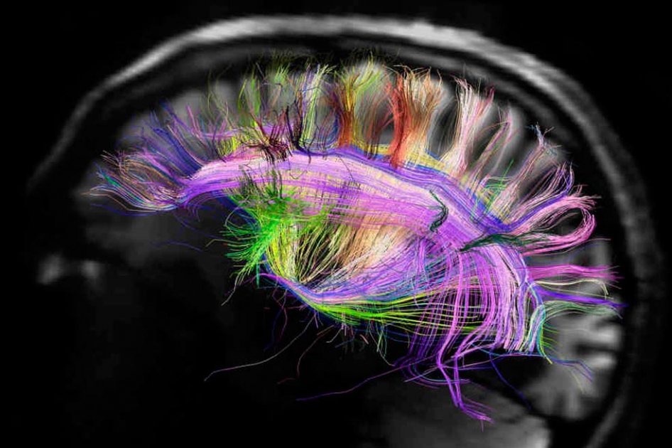 Imagen del cerebro que hace parte del Human Connectome Proyect, un esfuerzo por conocer mejor las estructuras y el funcionamiento de este órgano.