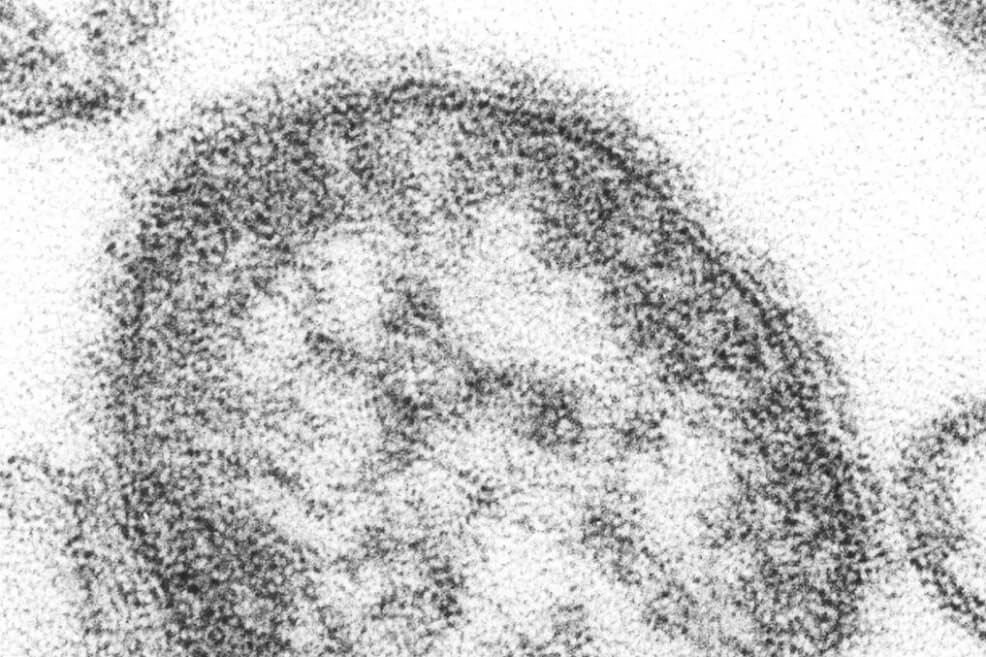 Los motivos por los que contraer sarampión significa estar más expuesto a infecciones