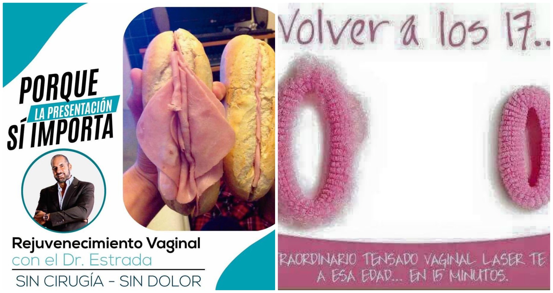 Se trata de imágenes que no son inocentes. Según explica la misma doctora Rogers en una encuesta realizada a 482 mujeres encontraron que el 78 % de ellas se había enterado de la reducción de labios vaginales por los medios. De alguna manera la apariencia de la vagina perfecta, joven y virgen sí se está vendiendo.