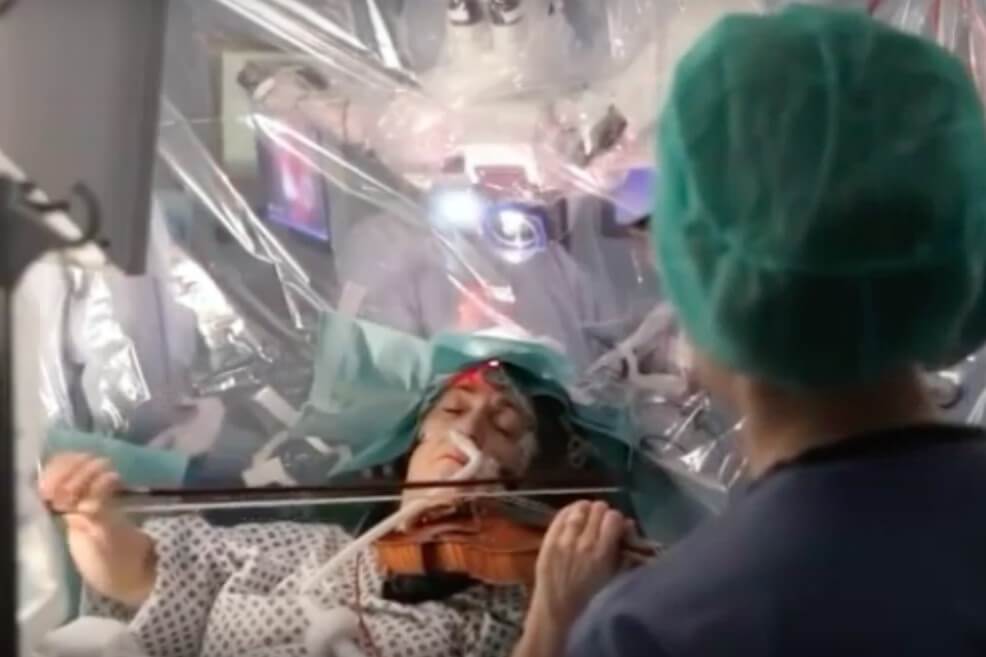 Mujer tocó un violín mientras le practicaban una cirugía en el cerebro (video)