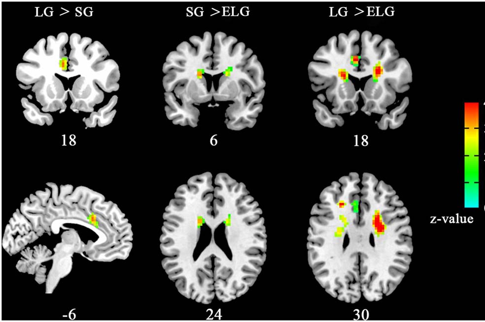 El amor visto al interior del cerebro