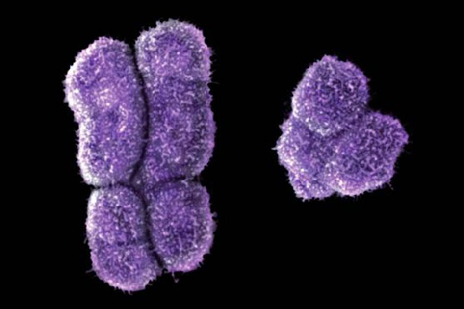 El cromosoma Y humano (derecha), es mucho más pequeño que el cromosoma X (izquierda). Estos dos cromosomas determinan el sexo en los humanos / Sinc. 