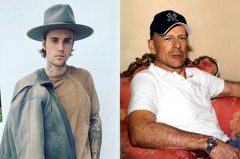 Bruce Willis, Justin Bieber y otros famosos con extrañas enfermedades