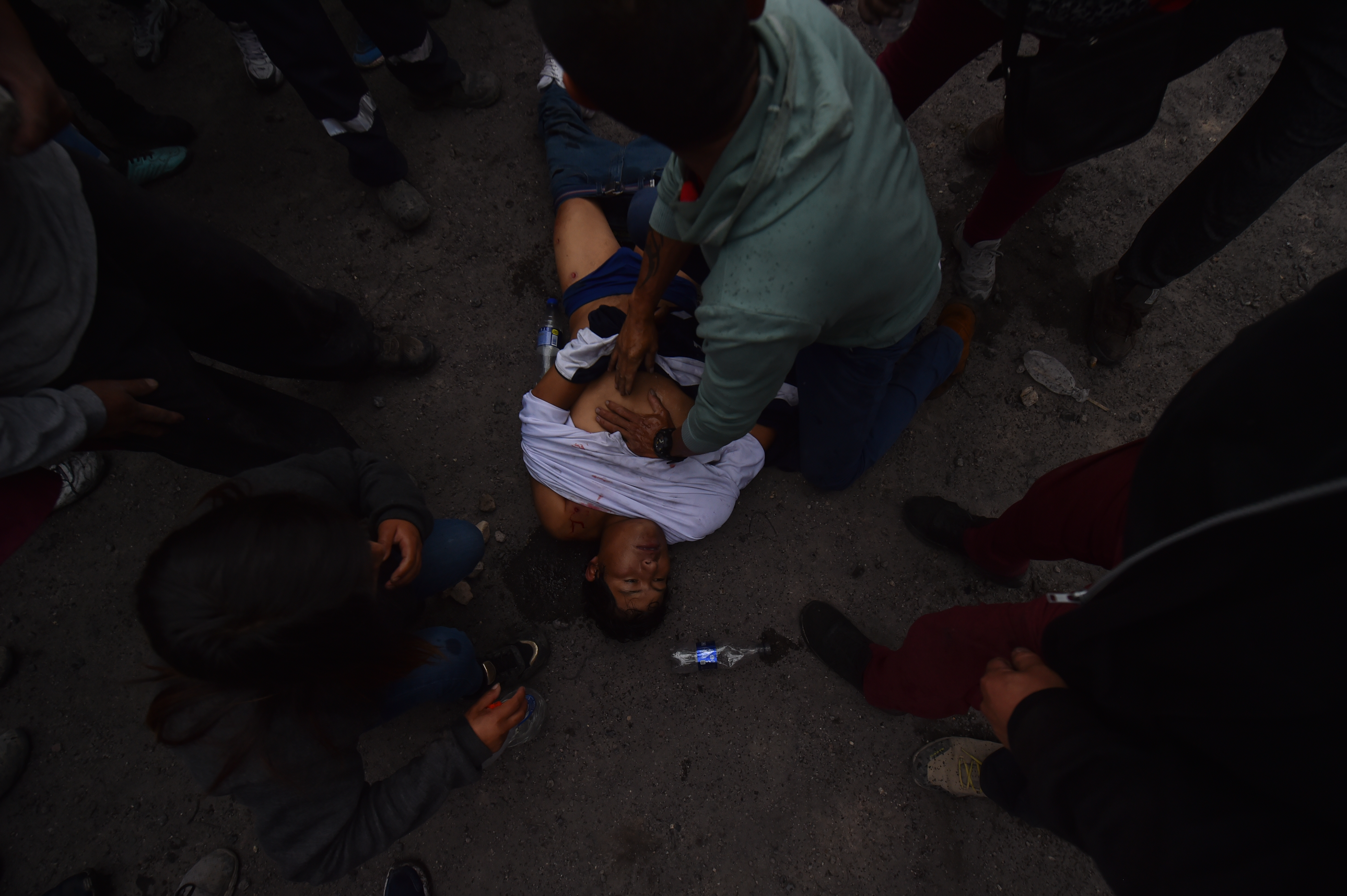 LIM01. AREQUIPA (PERÚ), 19/01/2023.- Un grupo de manifestantes tratan de ayudar a un herido de gravedad durante una marcha contra el Gobierno de la presidenta Dina Boluarte hoy, en Arequipa (Perú). La gran marcha nacional denominada "la toma de Lima", que pide la renuncia de la presidenta Dina Boluarte, ha activado una serie de acciones de protesta en distintos puntos del país. Hasta el momento, las protestas han dejado 43 manifestantes y un policía muertos. Los manifestantes exigen la renuncia de Boluarte y el cierre del Congreso, así como la convocatoria a elecciones generales para este año y a una asamblea constituyente. EFE/ Jose Sotomayor Jiménez ATENCIÓN EDITORES: MATERIAL GRÁFICO EXPLICITO