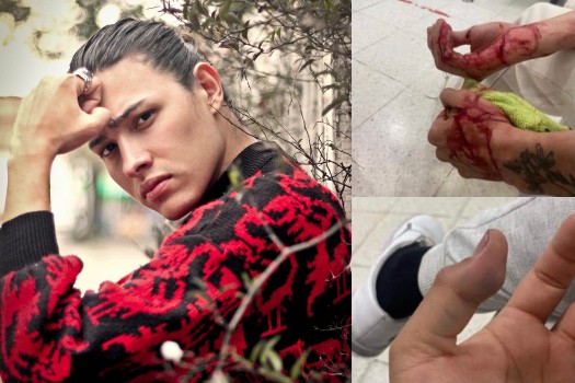 ¿Atraco o atentado? Actor que trabaja con víctimas, fue apuñalado en Bogotá