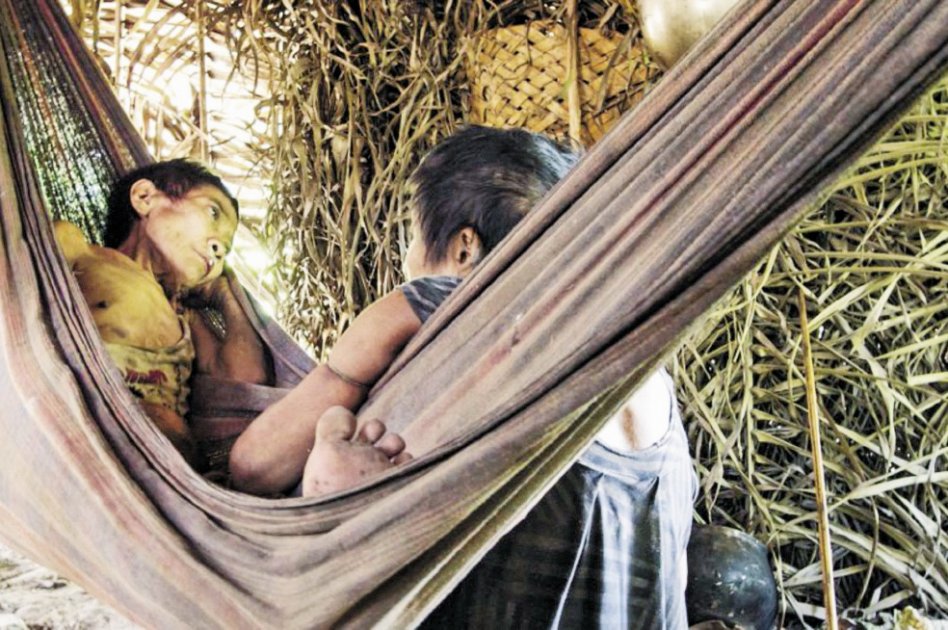 En la imagen se observa una mujer awá guajá enferma después de romper su aislamiento. /Survival International