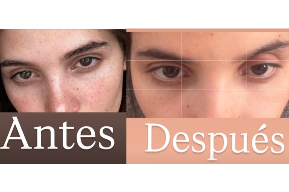 Mara Cifuentes, feminización facial.