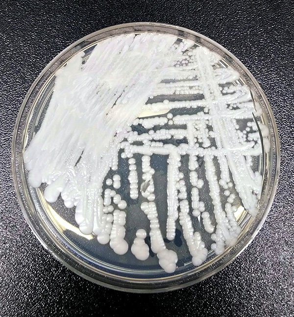 Una placa de Petri repleta de colonias de Candida auris, un hongo patógeno humano. /Foto: SHAWN LOCKHART / CDC