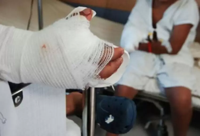 Denuncian negligencia policial en caso de hombre quemado con ácido en Fontibón