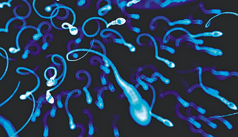 De la vasectomía a un gel anticonceptivo