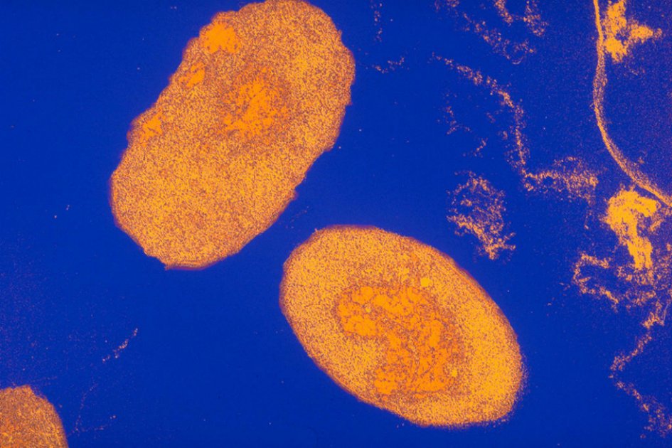 La tos ferina es producida po la bacteria Bordetella pertussis. 