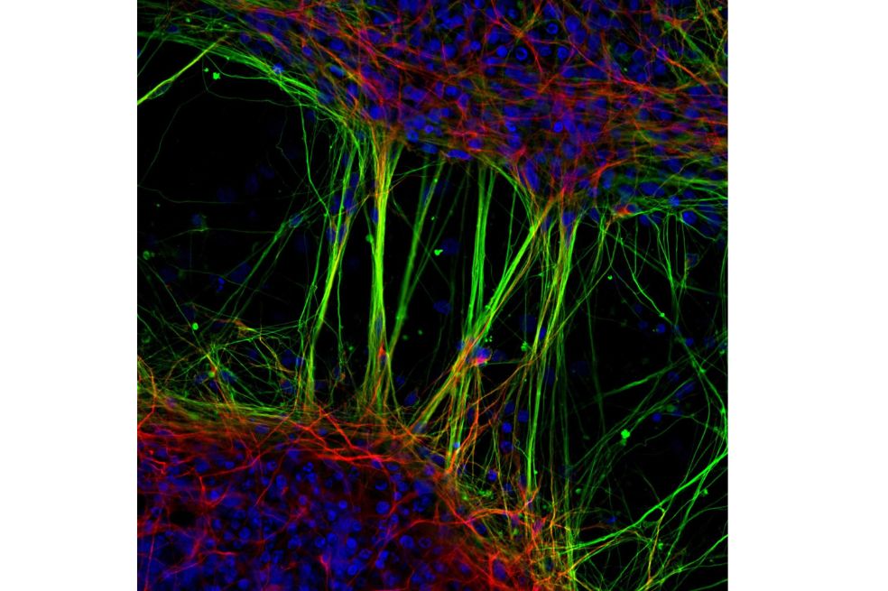 Neuronas humanas derivadas de células madre neurales