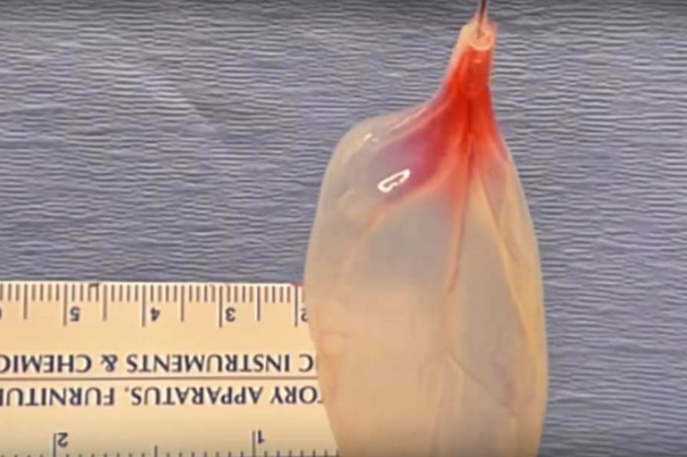 Crean tejido cardiaco humano a partir de las hojas de una espinaca