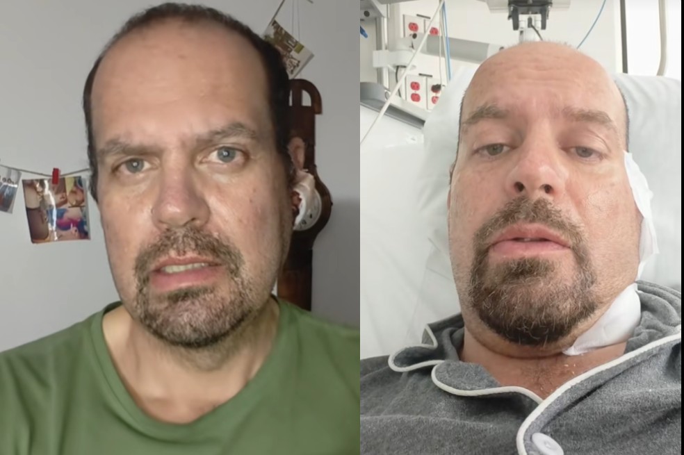 Andrés Bejar se recupera luego de su cirugía por tumor cancerígeno: “muy dolorosa”