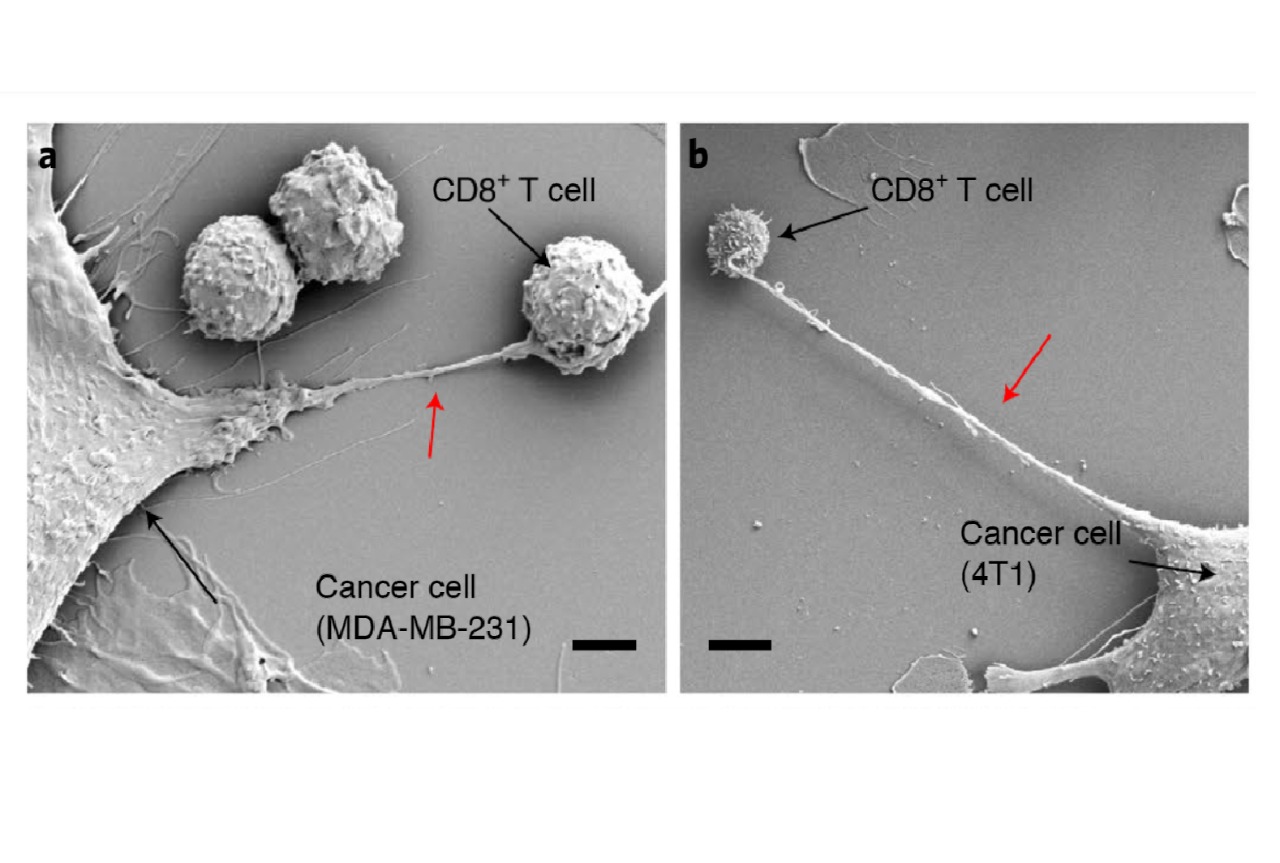 Así hacen las células cancerosas para quedarse con la energía de otras células
