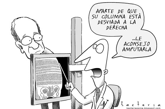 Obdulicosas (desviación de columna)