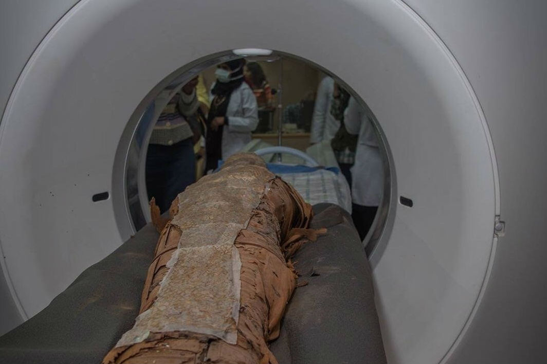 Haciendo un TAC a cuatro momias, detectaron el caso más antiguo de cáncer de mama