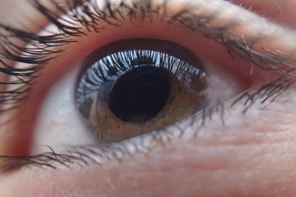 Glaucoma, una enfermedad silenciosa que deteriora el campo visual