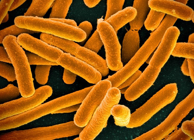 Imagen de bacterias "Escherichia coli", que pueden causar Enfermedad Diarreica Aguda.