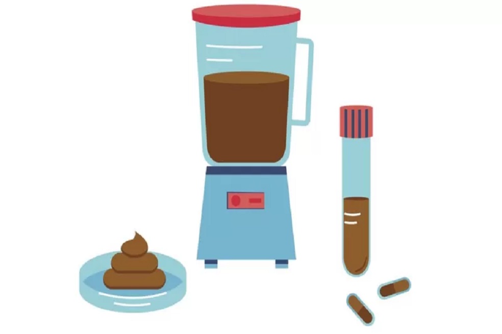 Trasplante fecal, ¿cómo el popó ayudaría en el tratamiento contra el cáncer?