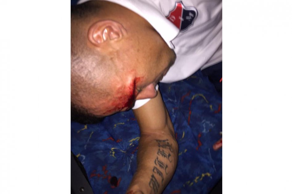 Vladimir Marín fue herido por una piedra a la salida del Manuel Murillo Toro