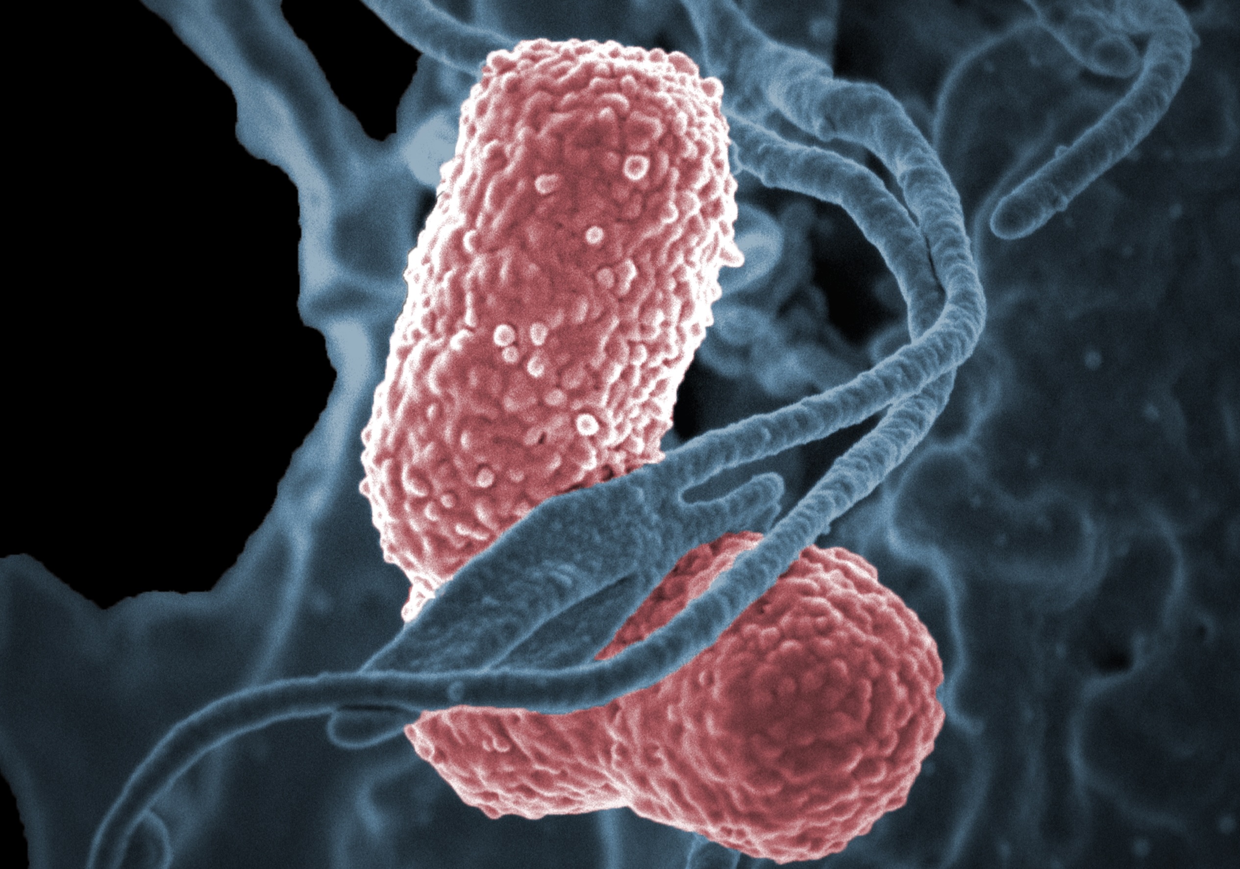 Bacterias superresistentes en hospitales colombianos