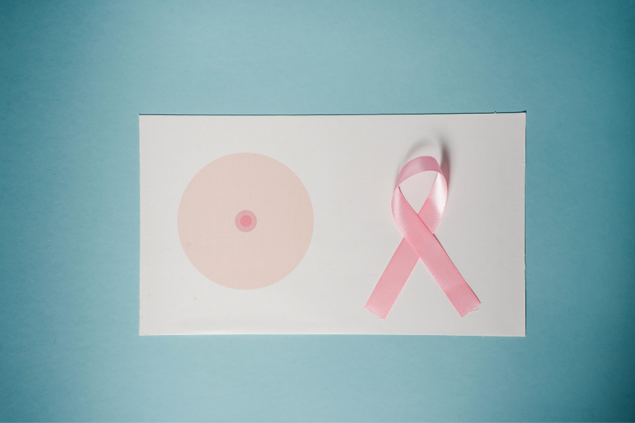 El cáncer de mama está afectando cada vez más a personas jóvenes y con malos hábitos