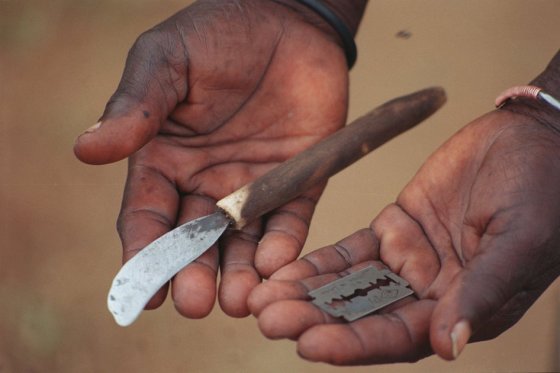 Mutilación genital afecta a 30 millones de mujeres, dice activista Koso-Thomas