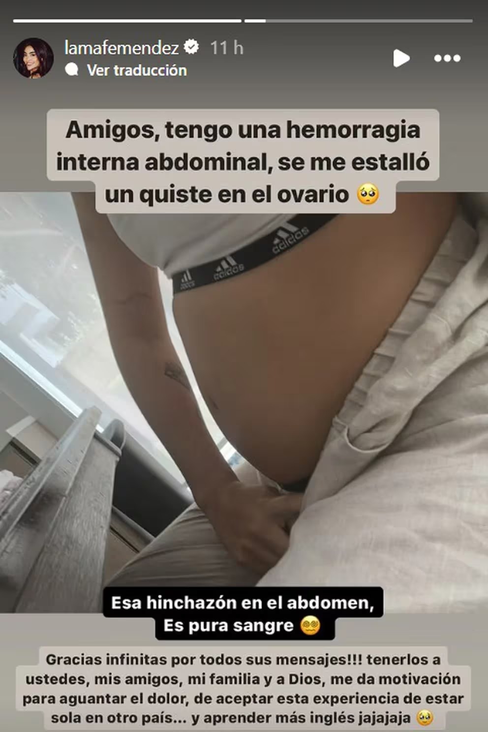 ¿Qué pasa si tengo un quiste en los ovarios? Famosa influencer lo sufrió