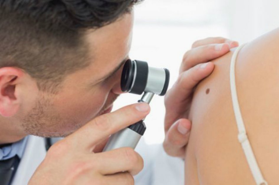 Jornadas gratuitas de detección de cáncer de piel en Colombia