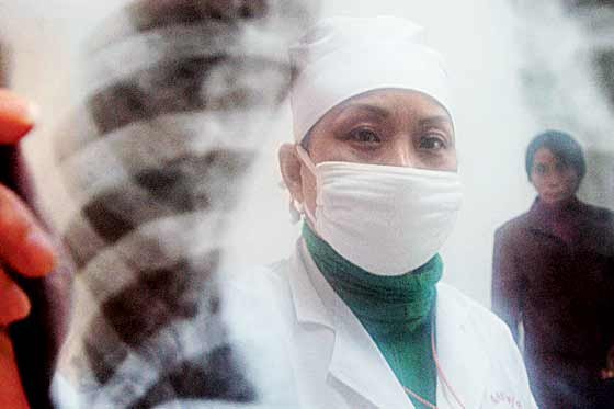 Lucha contra tuberculosis requiere US$1.600 millones anuales extra