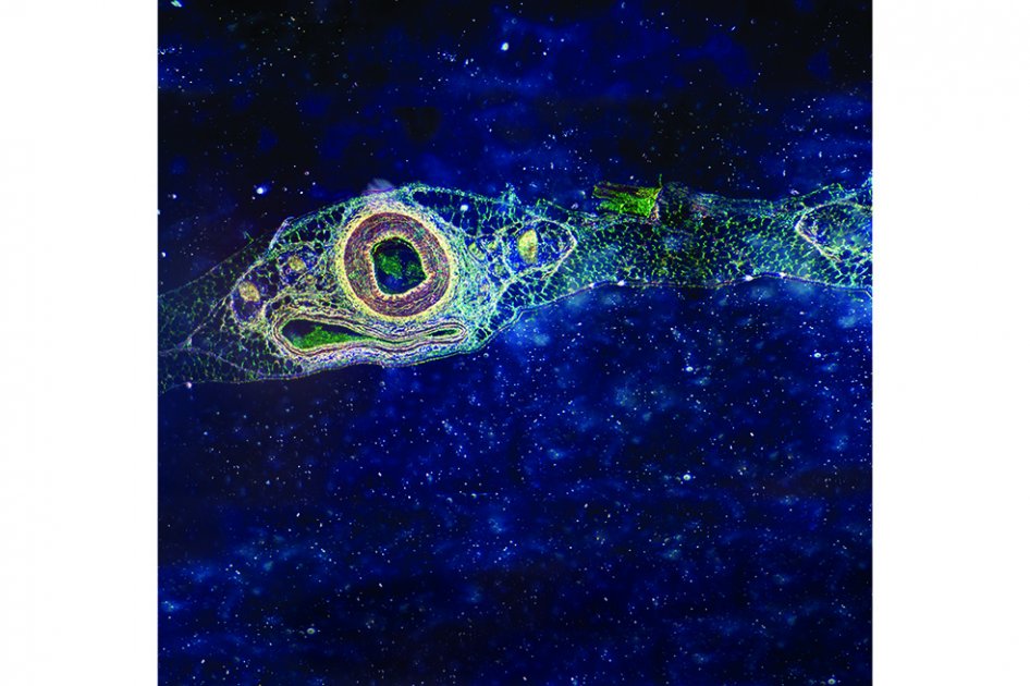 Donar una “galaxia” para salvar una vida