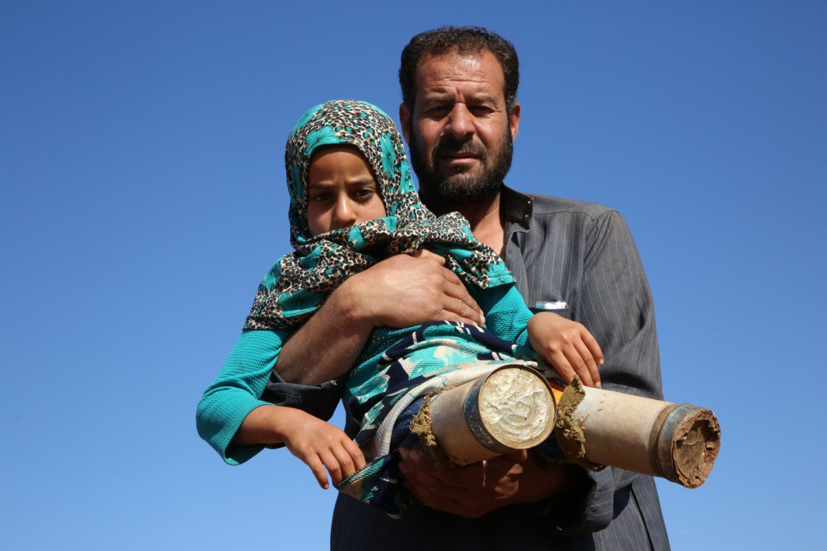 La historia de la niña siria que usa latas en lugar de prótesis