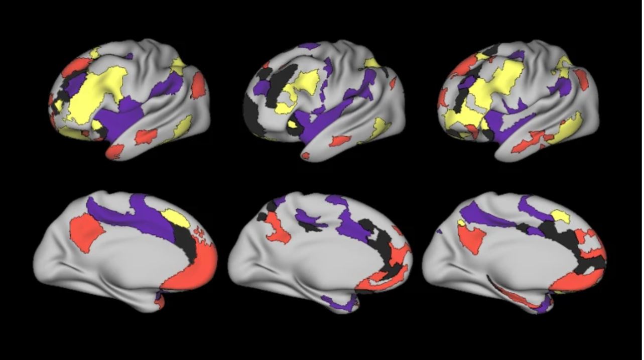 Científicos descubren cómo la depresión cambia una importante red del cerebro