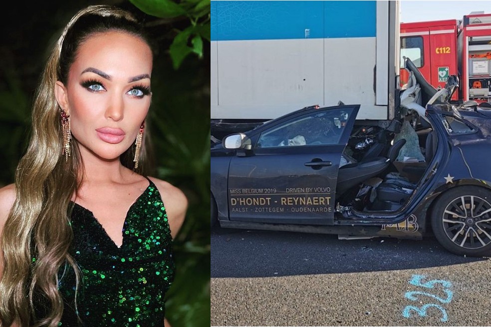 Miss Bélgica, de Miss Universo, sufrió grave accidente de tránsito. Casi muere