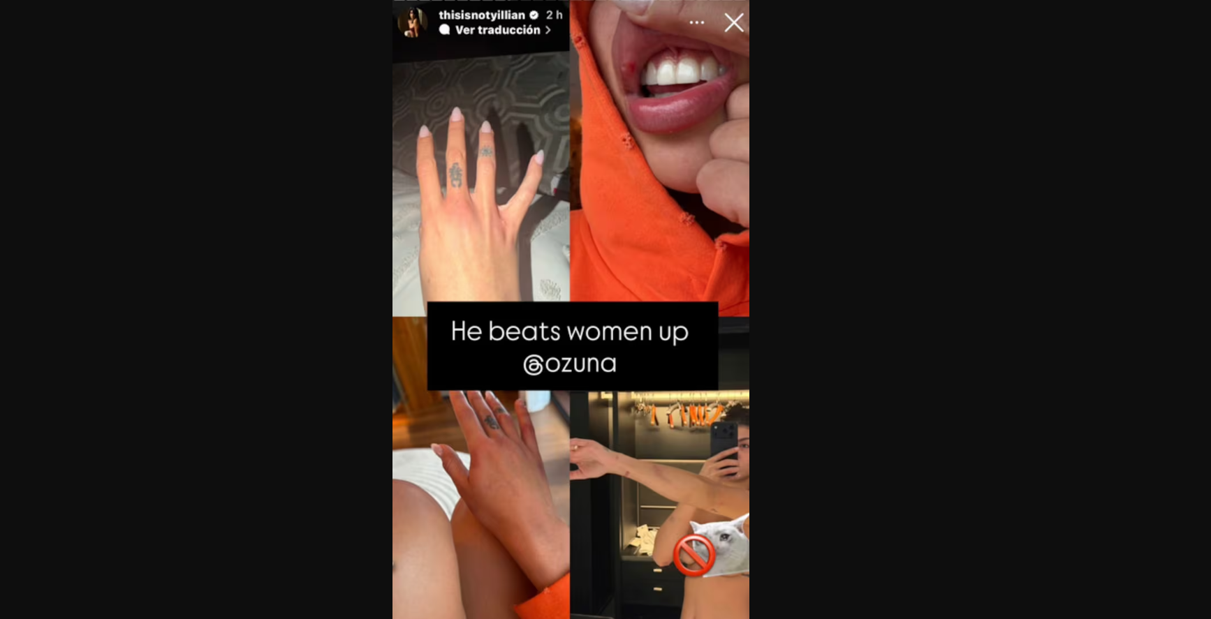 Ella es Yillian Atkinson, exparticipante de ‘Guerreros’ que acusa a Ozuna de maltrato físico