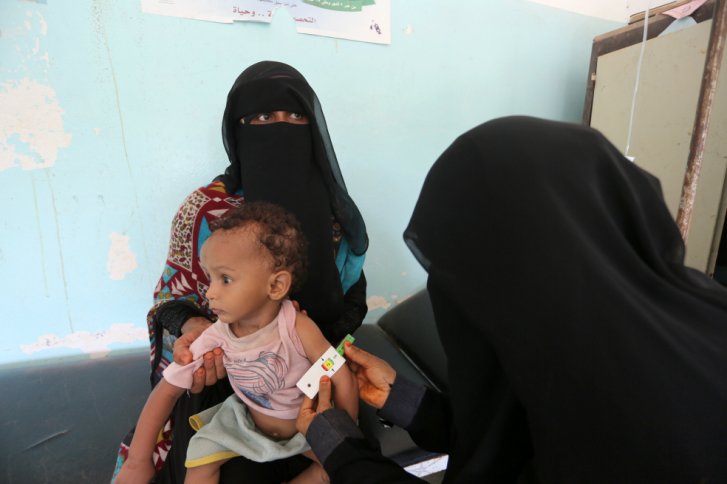 En Yemen un niño muere cada diez minutos debido a malnutrición