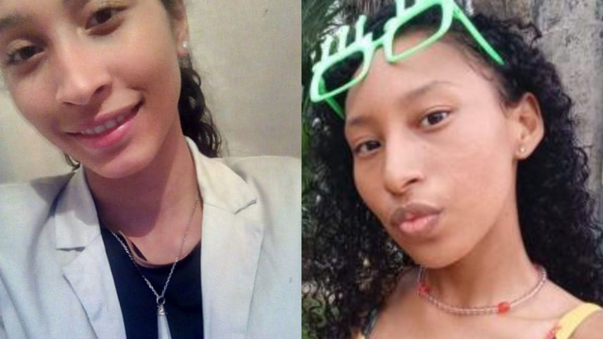 Joven murió tras someterse a una cirugía de cordales al sur de Bogotá: esto sucedió