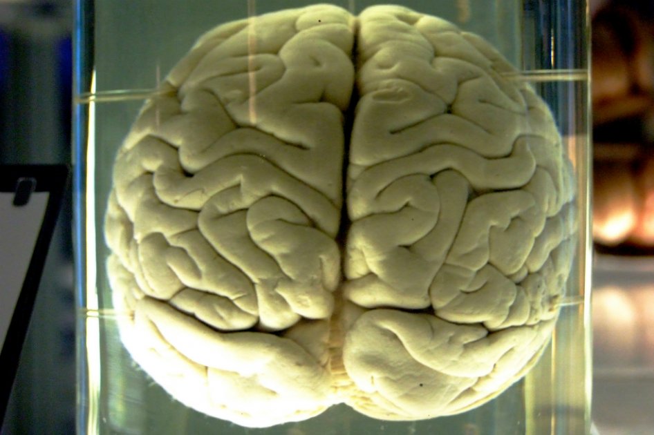 Los cerebros de los matemáticos desarrollan regiones diferentes a las del lenguaje. / Wikipedia