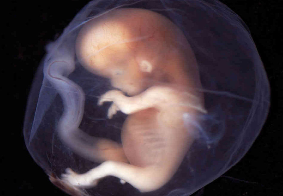 Embrión humano de aproximadamente 19 semanas. / SWRC.com