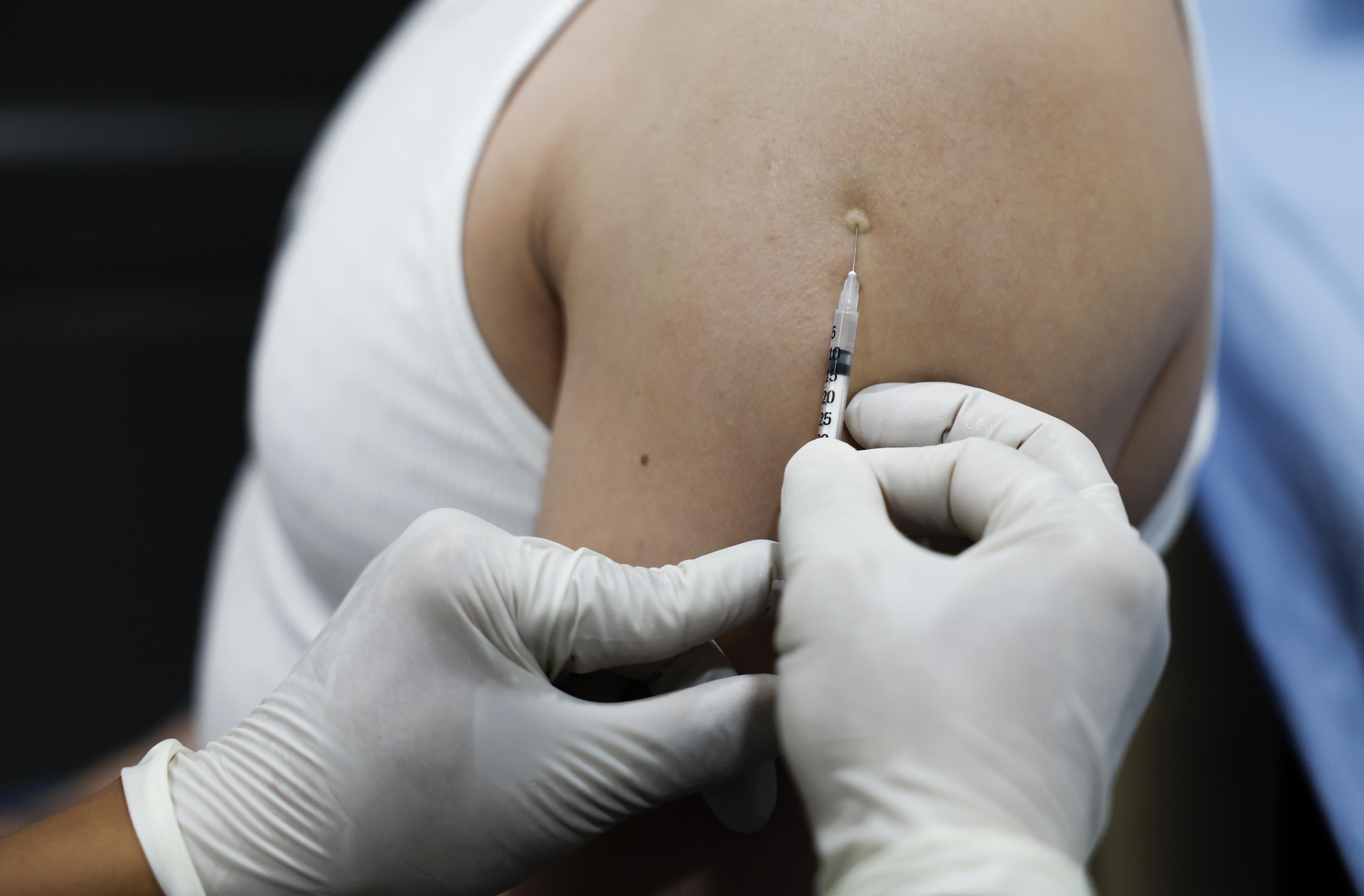 ¿Realmente se “perdieron” 25.000 vacunas contra el mpox en Colombia? No es tan sencillo