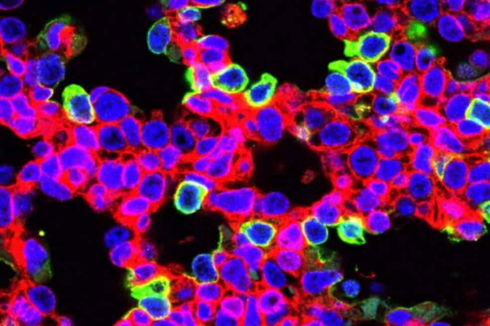 Científicos eliminan el gen causante de una enfermedad pulmonar mortal en ratones