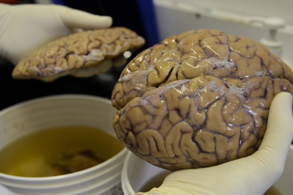 Así es el único banco de cerebros del país