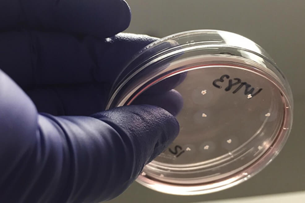 Minicerebros creados en laboratorio desarrollan redes neuronales funcionales