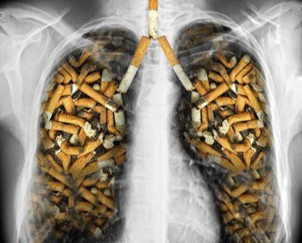 ¿Cómo limpiar los pulmones? Realmente existe una forma de hacerlo