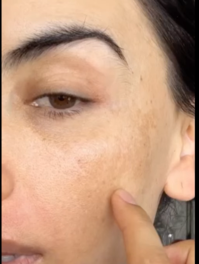 Jessica Cediel mostró sin filtros el problema en su piel que pocos conocían